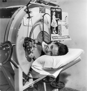 An eight-year-old polio victim in an “iron lung” respirator at North Carolina Memorial Hospital in Chapel Hill, ca. 1954. The March of Dimes poster and receptacle for contributions suggest that this may have been a promotional photograph to encourage donations to the campaign against polio. North Carolina Collection, University of North Carolina at Chapel Hill Library.