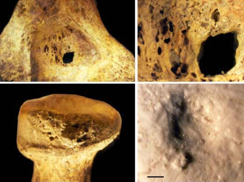 Bones from Kennewick Man